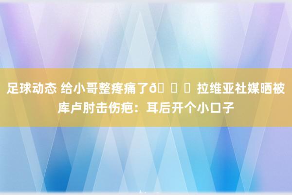 足球动态 给小哥整疼痛了😅拉维亚社媒晒被库卢肘击伤疤：耳后开个小口子